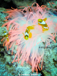Pink Anemone by Federico Senesi 